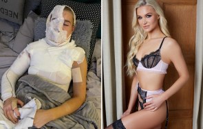 Abby Quinnen Says She Finally Feels Sexy Again 15 Months After Fireball Accident Dancer Abby Quinnen Poses In Her Underwear After Recovering From A Severe Burn.